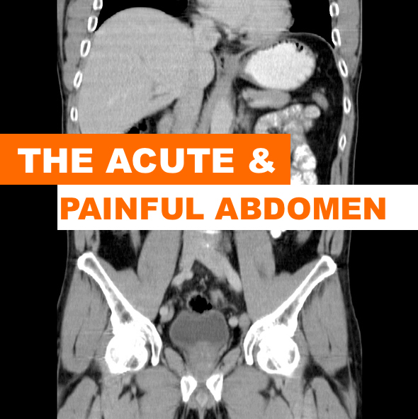 The Acute and Painful Abdomen