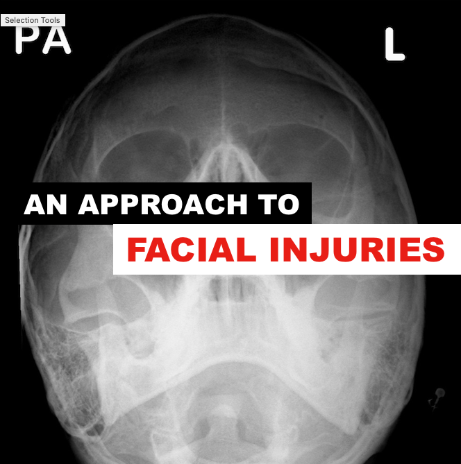 An Approach To Facial Injuries (Part I & II)